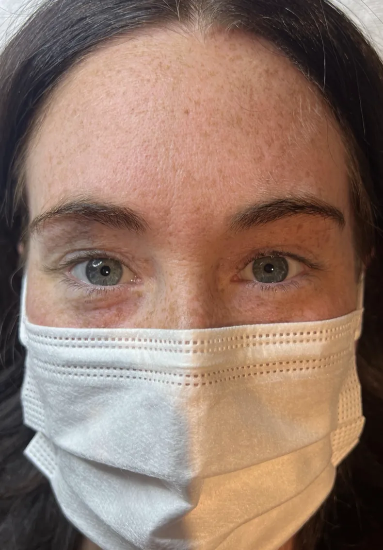 Lash lift before — Aura Beauty Atelier Etobicoke