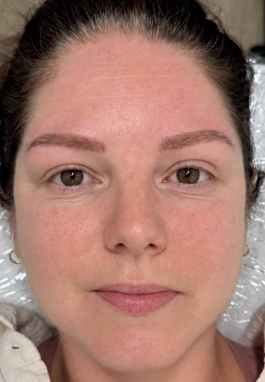 Nano brows after treatment by Larissa at Aura Beauty Atelier in Etobicoke