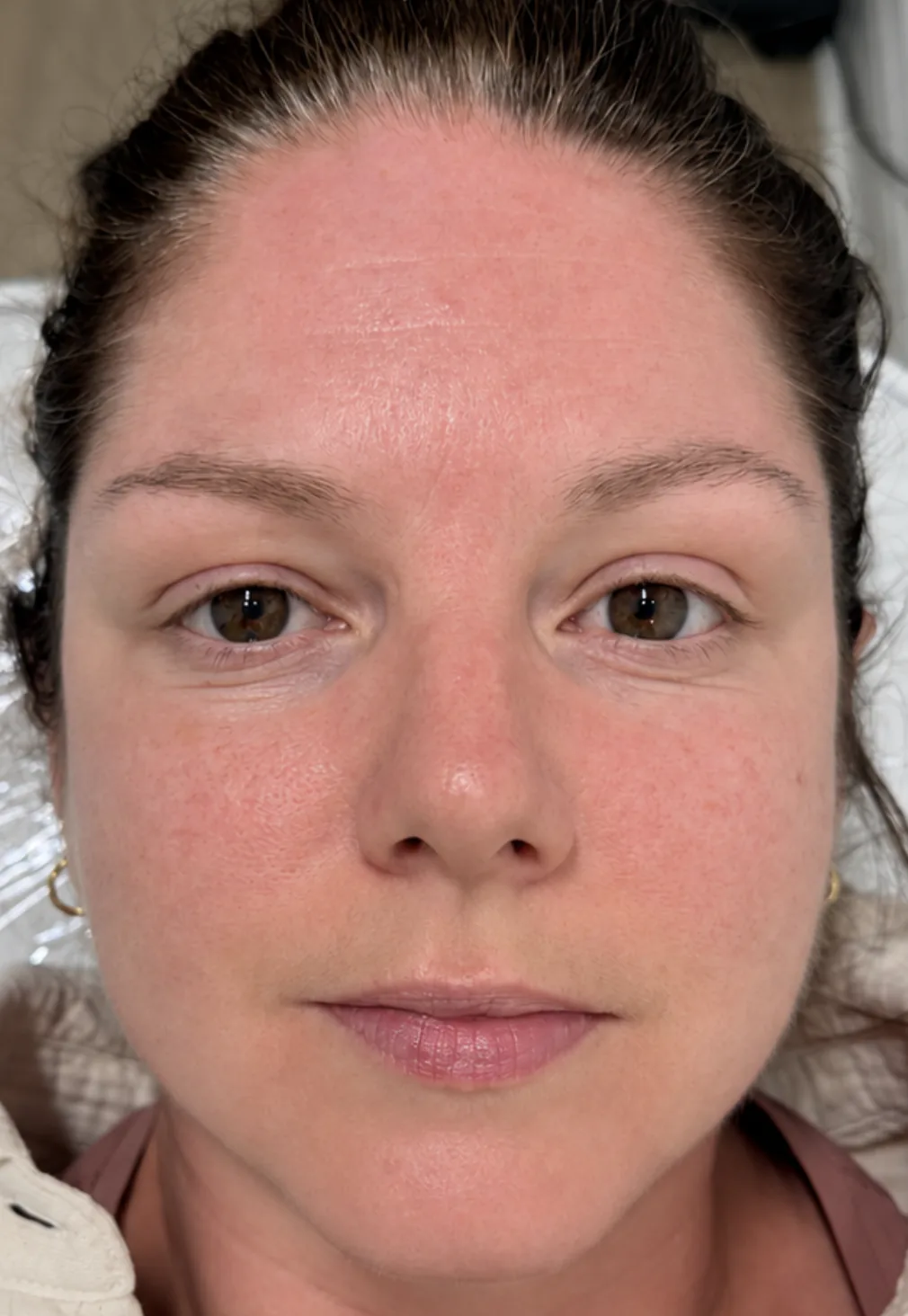 Natural brows before nano brow treatment at Aura Beauty Atelier in Etobicoke