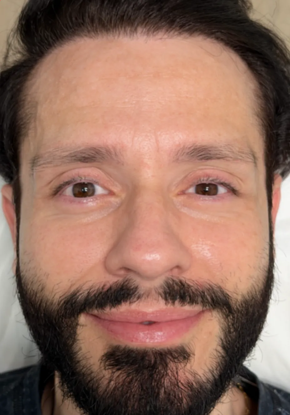Men's nano brows before — Aura Beauty Atelier Etobicoke