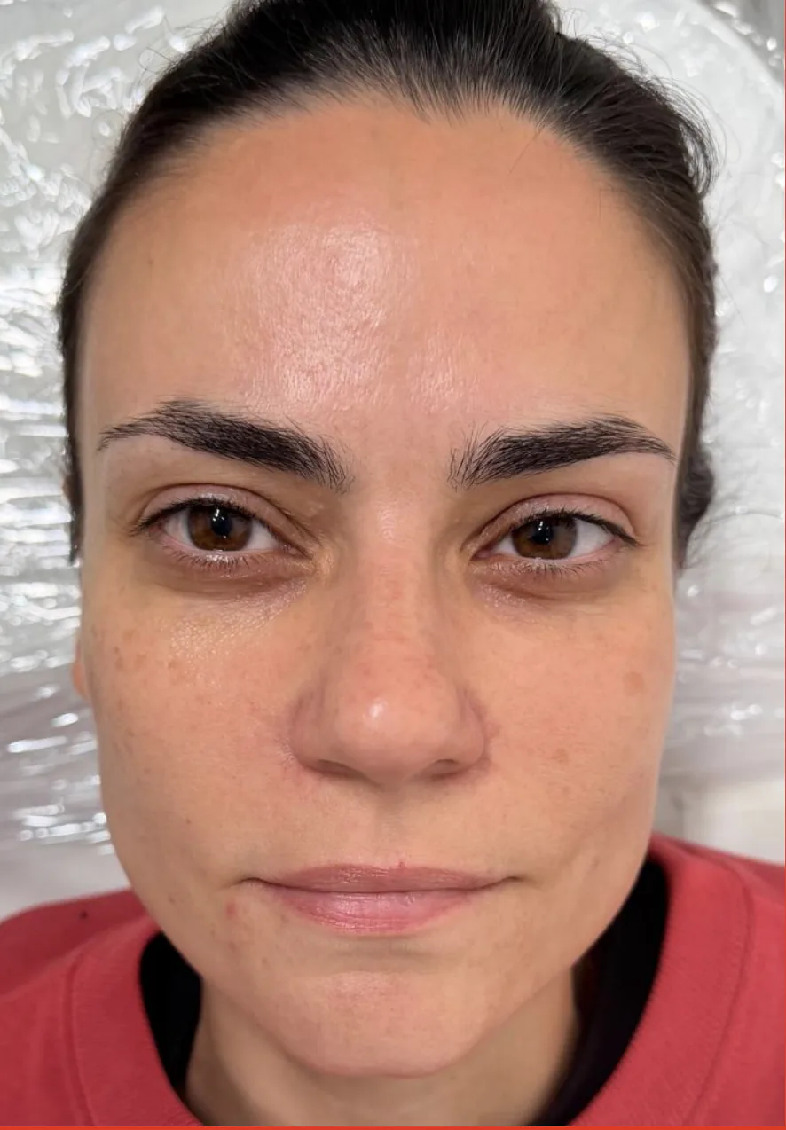Natural brows before nano brow treatment at Aura Beauty Atelier in Etobicoke